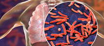 Kuman Tuberkulosis