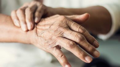 Parkinson